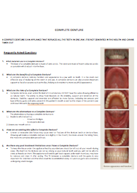 dentist-camberwell-info-Complete Denture