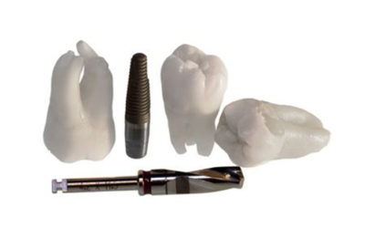 Steps involving an implant