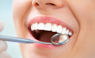Smile dental and teeth whitening at Hartwell Dentist Camberwell