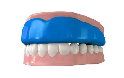 WHY DO I NEED CUSTOM FIT MOUTHGUARD?