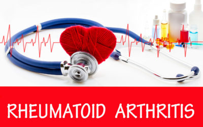 Rheumatoid Arthritis and Oral Health